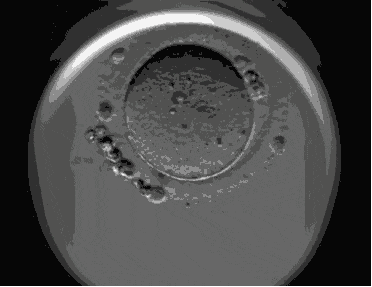 640_wx_fmt=gif&from=appmsg&tp=webp&wxfrom=5&wx_lazy=1&wx_co=1.gif